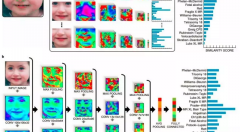 面部識別和人工智能可用于識別罕見遺傳病